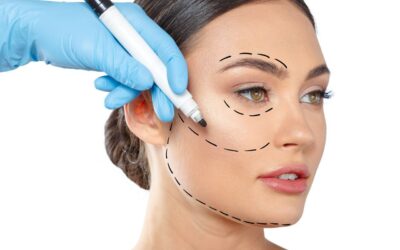 Cómo encontrar un buen cirujano plástico en Marbella para mi blefaroplastia