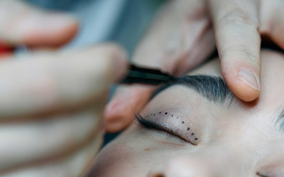 Cirugía Plástica Facial en Marbella: Descubre la Belleza que Transforma