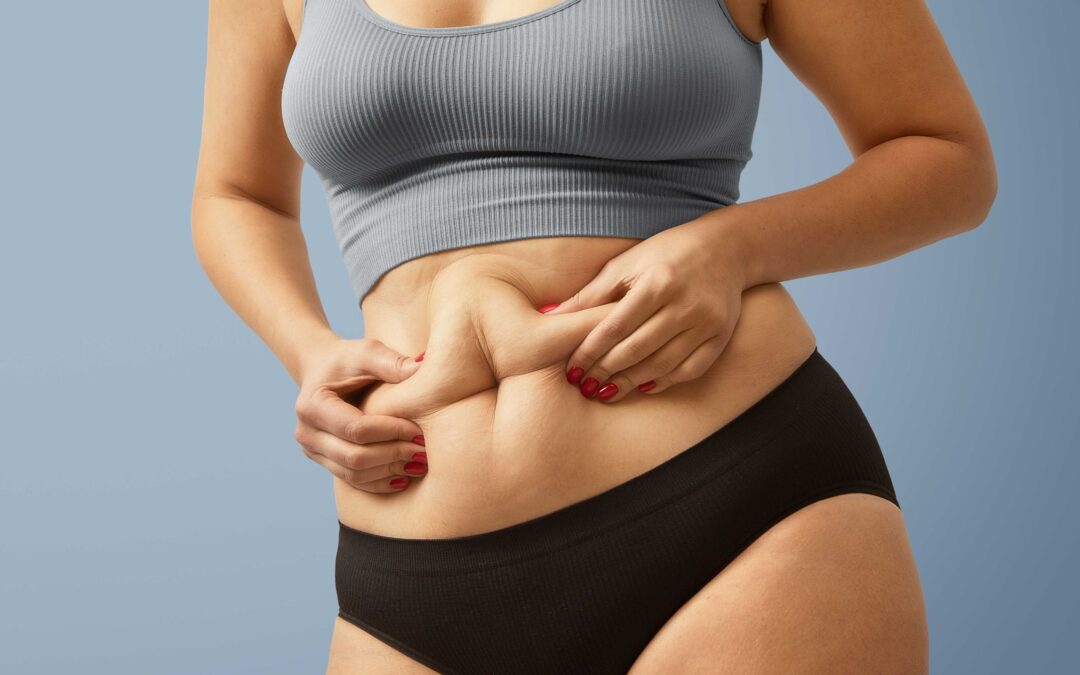 Especialistas en Abdominoplastias Marbella – Tu Guía Completa