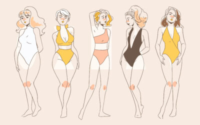 Descubre el Secreto de la Belleza en Marbella: Cirugía Plástica con Clínica Sánchez – López